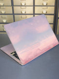 14431 2b-02-16 Skin Laptop